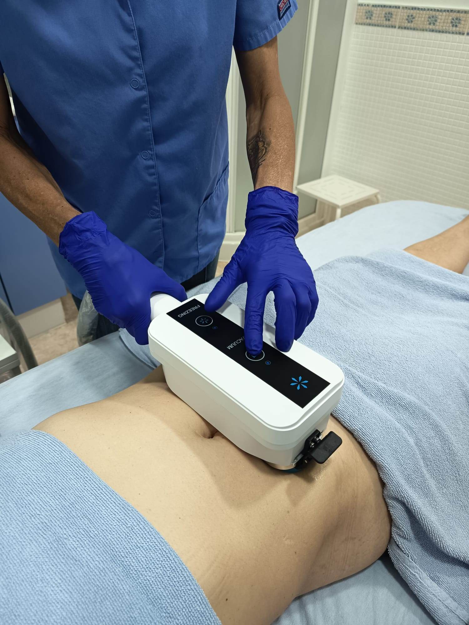 Aplicador de criolipólisis colocado en el abdomen